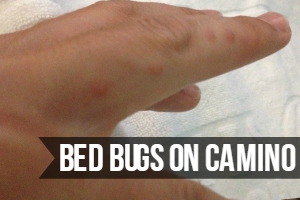 Bed Bugs on Camino de Santiago